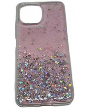 Silikonski ovitek z bleščicami SPARKLE za Xiaomi 11T / 11T Pro - roza - slika 2